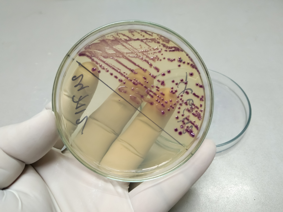 Рука в латексной перчатке держит чашку Петри с выросшими колониями бактерий на питательной среде